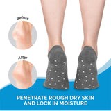 Gel Socks Moisturizing Foot Care